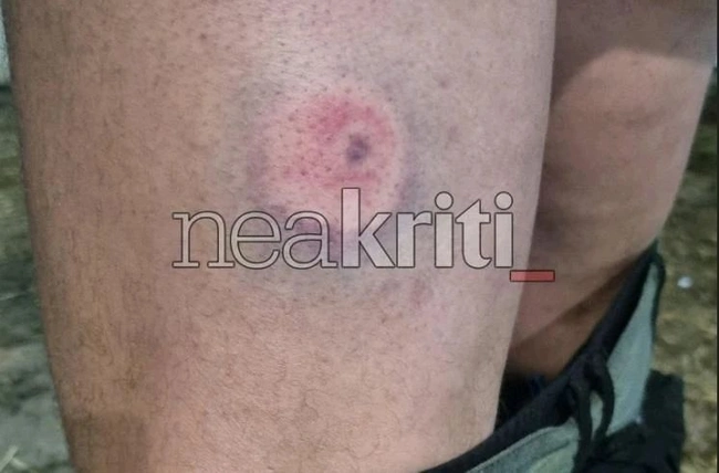 πλαστικές σφαίρες αγρότες 2
