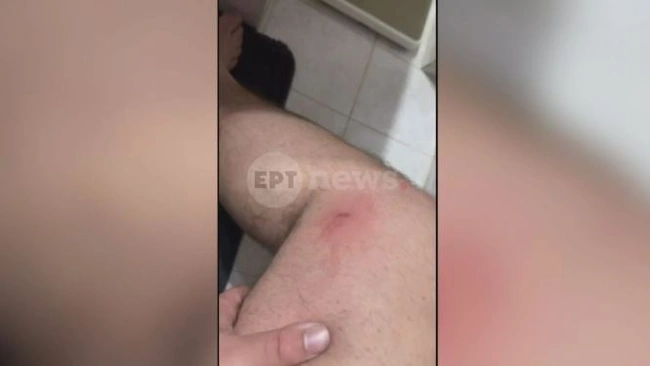 Αίγιο πυροβολισμοί κατά ανηλίκων