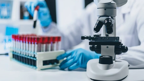 Θεραπεία για τον HIV