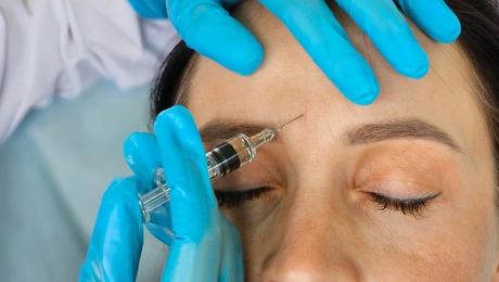 botox